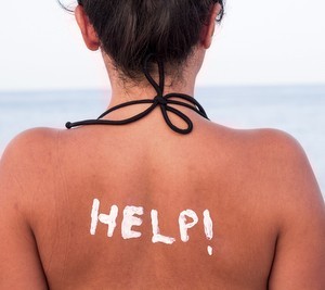 Got Sunburn? The Skin Care Strategies You Need to Help the Healing Begin