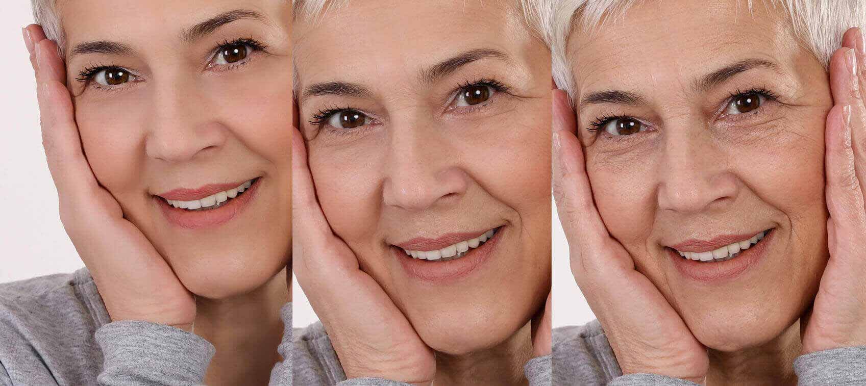 Ways to Ward Off Wrinkles