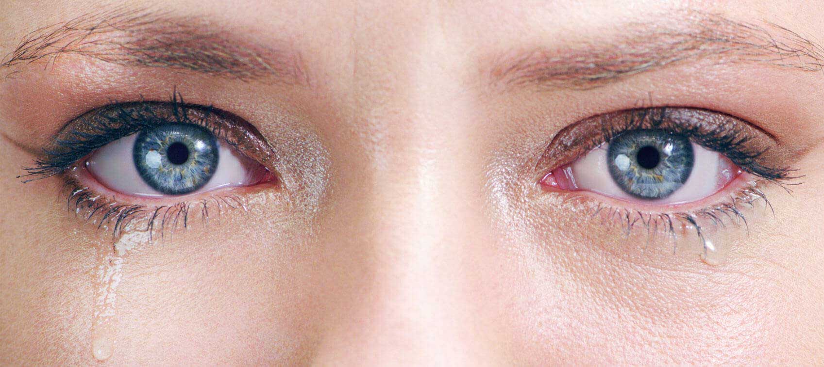 Ephiphora: What Causes Teary Eyes?