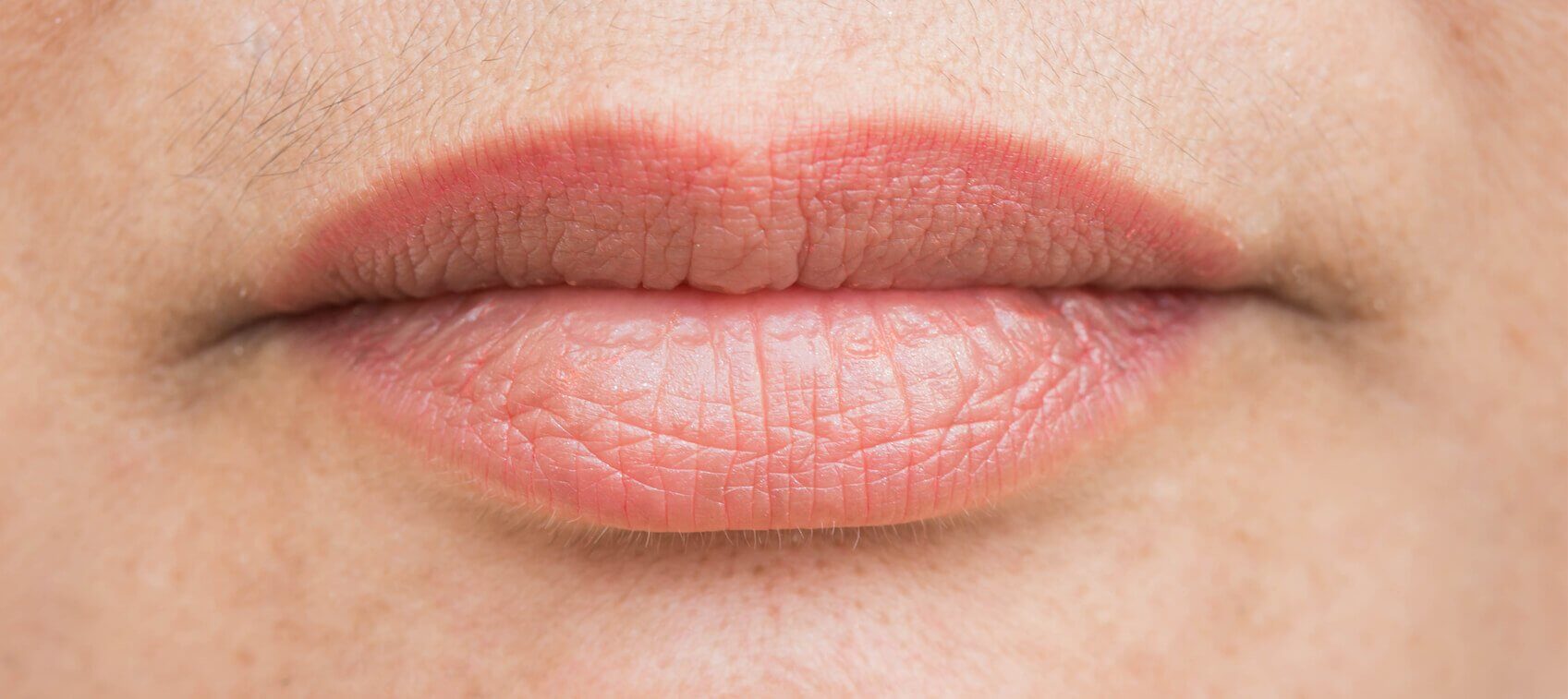 What Do Cracked Lips Look Like