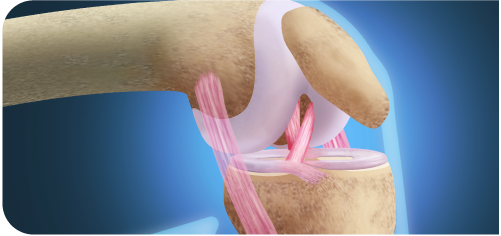 Healthy Joints