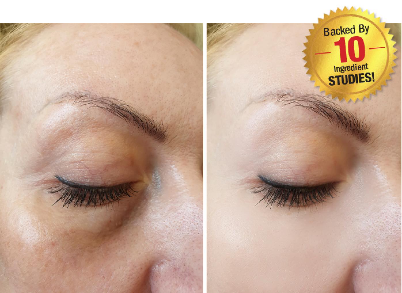 Before and After Skin Comparison