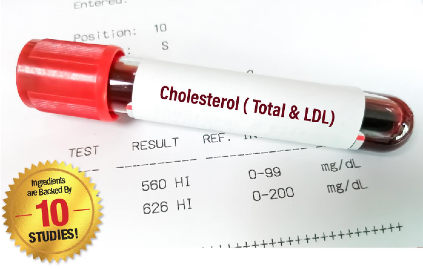 Cholesterol Test Sample